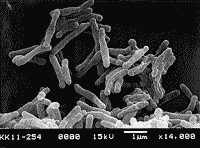 図5　結核菌の電子顕微鏡写真（財団法人結核予防会結核研究所より）