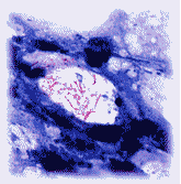 図6　喀痰中の結核菌（チール・ネルゼン染色の1000倍）の写真