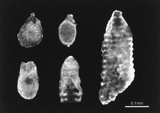 保津峡泥岩中の放散虫化石。顕微鏡写真。右端はRistola altissima、中央下段がArchaeodictyomitra