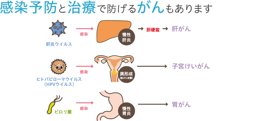 感染予防と治療で防げるがんもあります