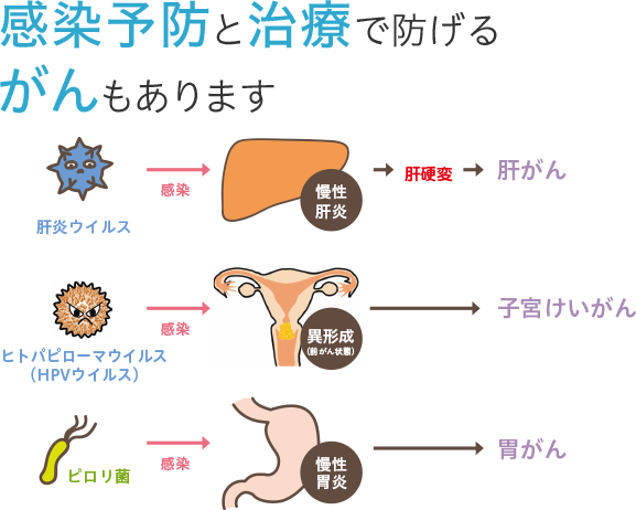 感染予防と治療で防げるがんもあります