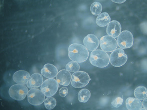 海洋センター海面育成施設内に出現した赤潮原因種（ノクチルカシンチランス）の顕微鏡写真
