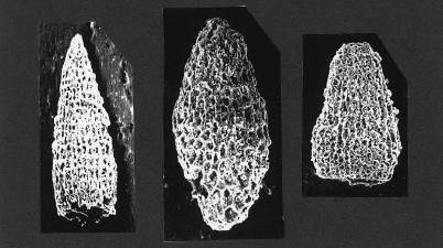 亀石と同じ酸性疑灰岩より産した放散虫の走査型電顕写真。長さ0.3mm程度。左端のものがParahsuum simplum