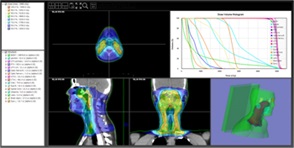 3D放射線画像・治療計画画像解析ツール「Growth RTV」