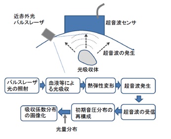 光超音波