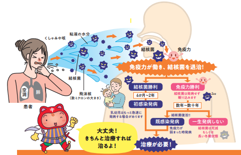 infection